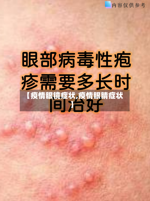 【疫情眼镜症状,疫情眼睛症状】