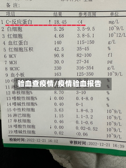 验血查疫情/疫情验血报告-第2张图片
