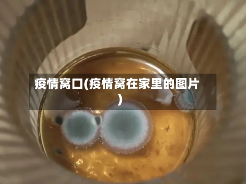 疫情窝口(疫情窝在家里的图片)-第3张图片