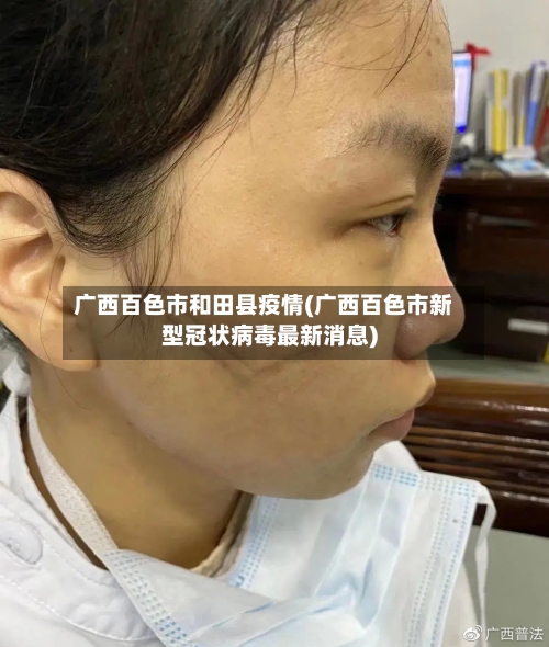 广西百色市和田县疫情(广西百色市新型冠状病毒最新消息)-第2张图片